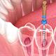 عوامل موثر در شکست درمان ریشه دندان